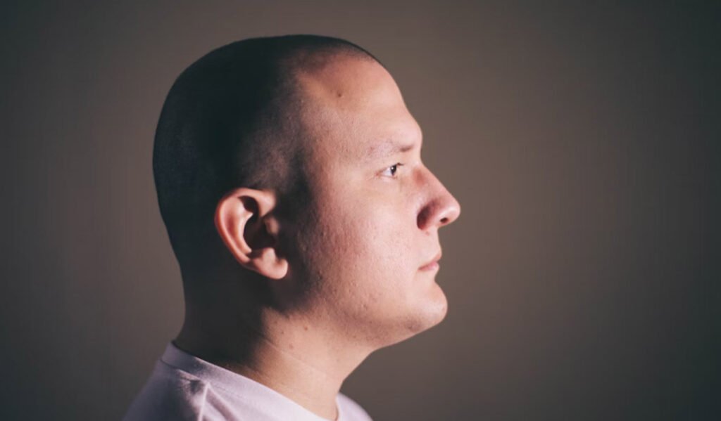 Best Hair Transplantation Method in India